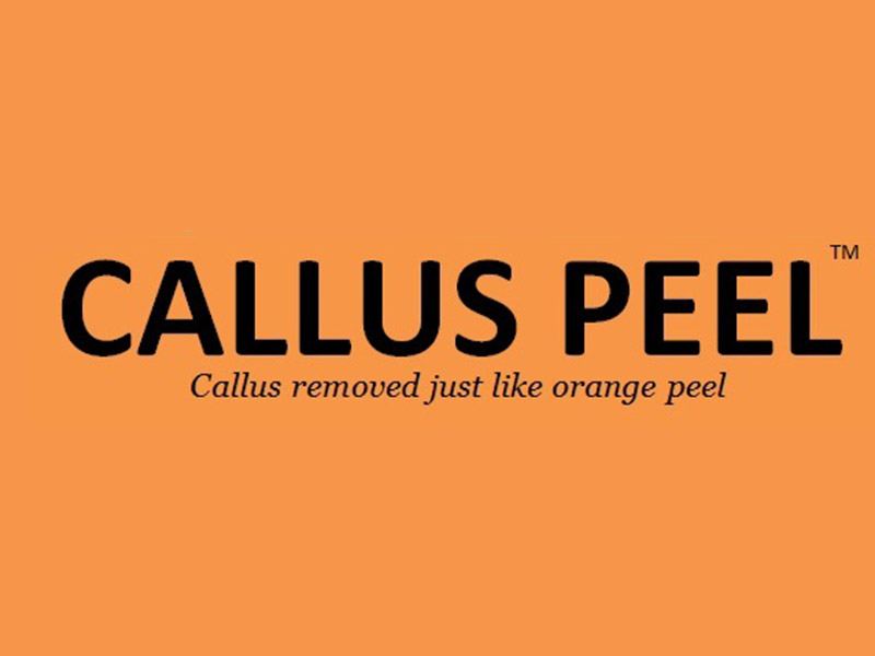 Calus Peel